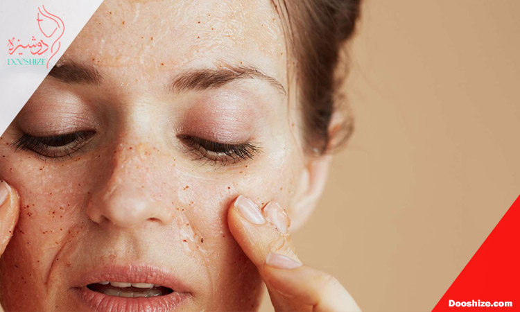 اختلال در سد دفاعی پوست؛ عامل پنهان جوش بعد از ماسک