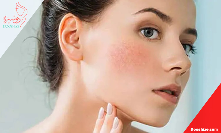 چرا پوست حساس بیش از سایر انواع پوست به محصولات آرایشی واکنش نشان می دهد؟